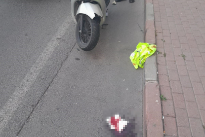 Motosikletten Düşen Sürücü Yaralandı