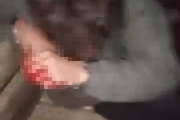 Çanakkale'de Kız Meselesi Yüzünden Tartıştığı Kişiyi Darbeden Şüpheli Tutuklandı