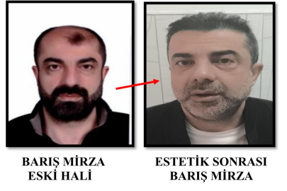 Ameliyat ile Yüzünü Değiştiren Firari Cinayet Zanlısı, 7 Yıl Sonra Yakalandı